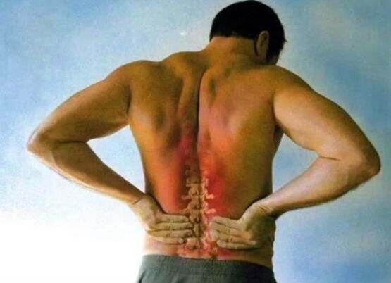Mina lumbar osteochondrosis